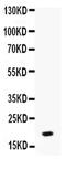 Pro-Platelet Basic Protein antibody, PA5-79853, Invitrogen Antibodies, Western Blot image 