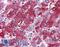 Proprotein Convertase Subtilisin/Kexin Type 6 antibody, LS-A7952, Lifespan Biosciences, Immunohistochemistry paraffin image 