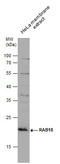 RAB18, Member RAS Oncogene Family antibody, GTX131055, GeneTex, Western Blot image 
