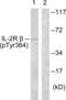 Interleukin 2 Receptor Subunit Beta antibody, LS-C199112, Lifespan Biosciences, Western Blot image 
