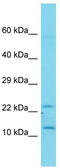 TAFA Chemokine Like Family Member 1 antibody, TA335324, Origene, Western Blot image 