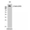 TSC Complex Subunit 2 antibody, LS-C381287, Lifespan Biosciences, Western Blot image 