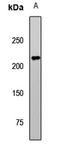 Tet Methylcytosine Dioxygenase 2 antibody, LS-C668553, Lifespan Biosciences, Western Blot image 