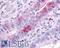 Mitogen-Activated Protein Kinase Kinase Kinase 9 antibody, LS-A7092, Lifespan Biosciences, Immunohistochemistry paraffin image 