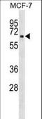 Ribitol Xylosyltransferase 1 antibody, LS-C162014, Lifespan Biosciences, Western Blot image 