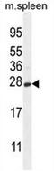 Crystallin Gamma S antibody, AP51093PU-N, Origene, Western Blot image 