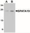 Spermatogenesis Associated 19 antibody, NBP2-41149, Novus Biologicals, Western Blot image 