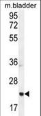 Achaete-Scute Family BHLH Transcription Factor 2 antibody, LS-C156537, Lifespan Biosciences, Western Blot image 