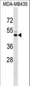 Potassium Voltage-Gated Channel Subfamily J Member 13 antibody, LS-B10200, Lifespan Biosciences, Western Blot image 