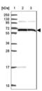 ALG8 Alpha-1,3-Glucosyltransferase antibody, NBP2-47550, Novus Biologicals, Western Blot image 