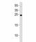 Lin-28 Homolog A antibody, F52805-0.4ML, NSJ Bioreagents, Western Blot image 