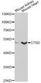 Cathepsin D antibody, A13292, ABclonal Technology, Western Blot image 