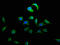 Docking Protein 5 antibody, LS-C317805, Lifespan Biosciences, Immunofluorescence image 