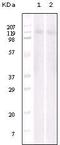 EPH Receptor B6 antibody, LS-C171361, Lifespan Biosciences, Western Blot image 