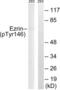 Ezrin antibody, LS-C198941, Lifespan Biosciences, Western Blot image 