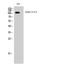 EPH Receptor B1 antibody, STJ92950, St John