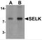 Selenoprotein K antibody, NBP2-81791, Novus Biologicals, Western Blot image 