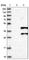 Deleted In Azoospermia Like antibody, HPA019593, Atlas Antibodies, Western Blot image 