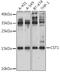 Cystatin SN antibody, GTX00786, GeneTex, Western Blot image 