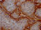 Integrin Subunit Alpha V antibody, CSB-RA279866A0HU, Cusabio, Immunohistochemistry frozen image 