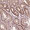AKT1 Substrate 1 antibody, NBP2-57165, Novus Biologicals, Immunohistochemistry paraffin image 