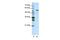 Cleavage And Polyadenylation Specific Factor 7 antibody, PA5-41910, Invitrogen Antibodies, Western Blot image 