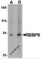 RB Binding Protein 8, Endonuclease antibody, 5761, ProSci, Western Blot image 