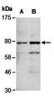 Forkhead Box P1 antibody, orb67039, Biorbyt, Western Blot image 