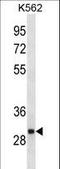 VAMP Associated Protein A antibody, LS-C157030, Lifespan Biosciences, Western Blot image 