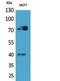 MPL Proto-Oncogene, Thrombopoietin Receptor antibody, PA5-51118, Invitrogen Antibodies, Western Blot image 