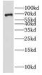 Polypeptide N-Acetylgalactosaminyltransferase 9 antibody, FNab03326, FineTest, Western Blot image 