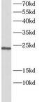 PTTG1 Regulator Of Sister Chromatid Separation, Securin antibody, FNab10150, FineTest, Western Blot image 