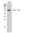 Estrogen Receptor 2 antibody, A00786S105-1, Boster Biological Technology, Western Blot image 