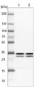 General Transcription Factor IIE Subunit 2 antibody, NBP1-87931, Novus Biologicals, Western Blot image 