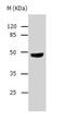 Hair keratin, type I Ha1 antibody, TA323041, Origene, Western Blot image 