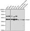 Proteasome 26S Subunit, Non-ATPase 7 antibody, A5356, ABclonal Technology, Western Blot image 