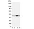 Apurinic/Apyrimidinic Endodeoxyribonuclease 1 antibody, R30567, NSJ Bioreagents, Western Blot image 