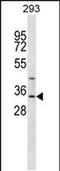 Glycine-N-Acyltransferase antibody, PA5-48504, Invitrogen Antibodies, Western Blot image 