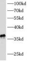 ATP Synthase Mitochondrial F1 Complex Assembly Factor 1 antibody, FNab00731, FineTest, Western Blot image 