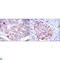 Eukaryotic Translation Elongation Factor 2 antibody, LS-C812575, Lifespan Biosciences, Immunofluorescence image 