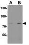 Protein Disulfide Isomerase Family A Member 4 antibody, GTX31622, GeneTex, Western Blot image 