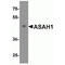 N-Acylsphingosine Amidohydrolase 1 antibody, TA306621, Origene, Western Blot image 