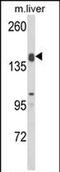 ADAM Metallopeptidase With Thrombospondin Type 1 Motif 18 antibody, PA5-72595, Invitrogen Antibodies, Western Blot image 