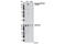 ERBB2 antibody, 2247S, Cell Signaling Technology, Western Blot image 