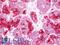 Aquaporin 1 (Colton Blood Group) antibody, LS-B11399, Lifespan Biosciences, Immunohistochemistry paraffin image 