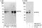 Mitogen-Activated Protein Kinase Kinase 4 antibody, A302-658A, Bethyl Labs, Immunoprecipitation image 