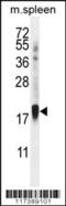 Zinc Finger Protein 593 antibody, 56-217, ProSci, Western Blot image 