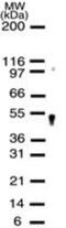 Apurinic/Apyrimidinic Endodeoxyribonuclease 2 antibody, GTX13691, GeneTex, Western Blot image 