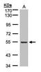 Integrin Linked Kinase antibody, GTX101691, GeneTex, Western Blot image 