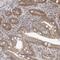 Outer Dense Fiber Of Sperm Tails 2 Like antibody, NBP1-82921, Novus Biologicals, Immunohistochemistry paraffin image 